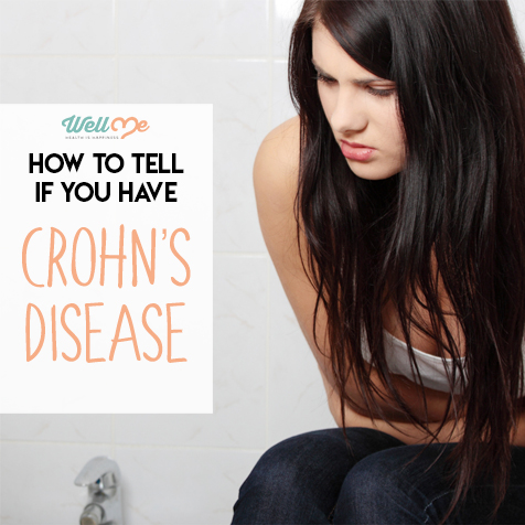 How to Tell if You Have Crohn's Disease