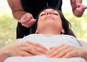 woman lying down receiving acupuncture to the face