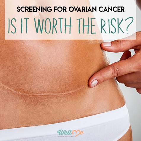 Screening For Ovarian Cancer: Is it Worth the Risk?