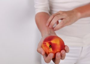 woman with a food intolerance to fruit itching her skin due to a reaction eating a peach