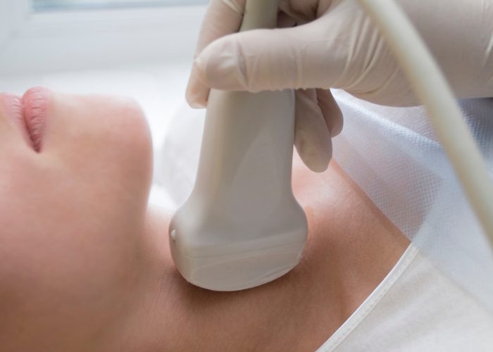 Woman getting a thyroid ultrasound 