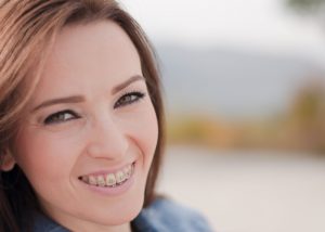 Woman with adult braces smiling