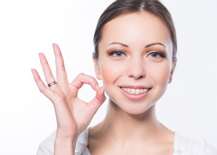 Woman smiling with ceramic braces and giving the ok sign