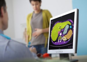 Doctor looking at a medical image of a female patient's liver