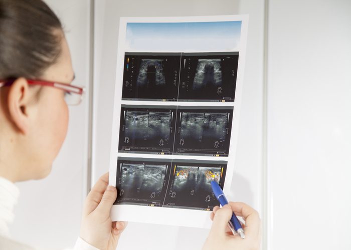 Doctor checking a print out of x-rays of a patient's thyroid