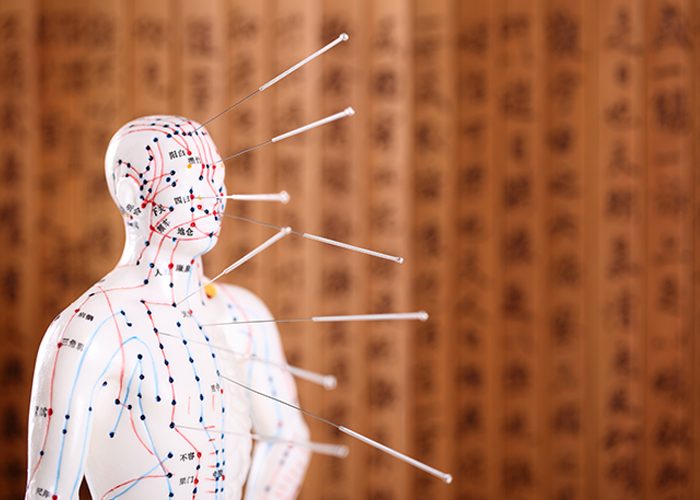 Acupuncture needles stuck in a figurine with meridians painted out