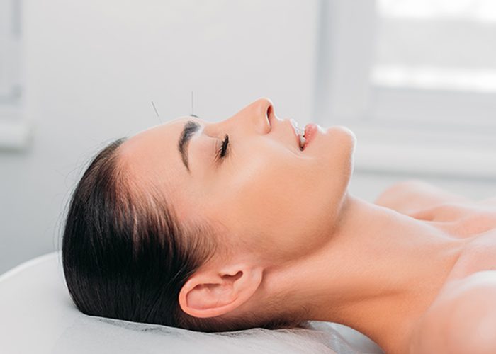 6 Acupuncture Benefits That’ll Make You Book Your First Session