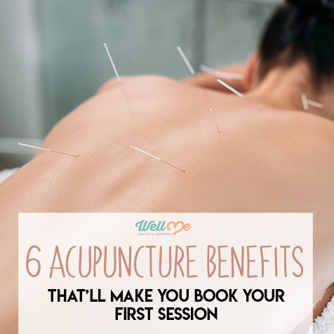 6 Acupuncture Benefits That'll Make You Book Your First Session