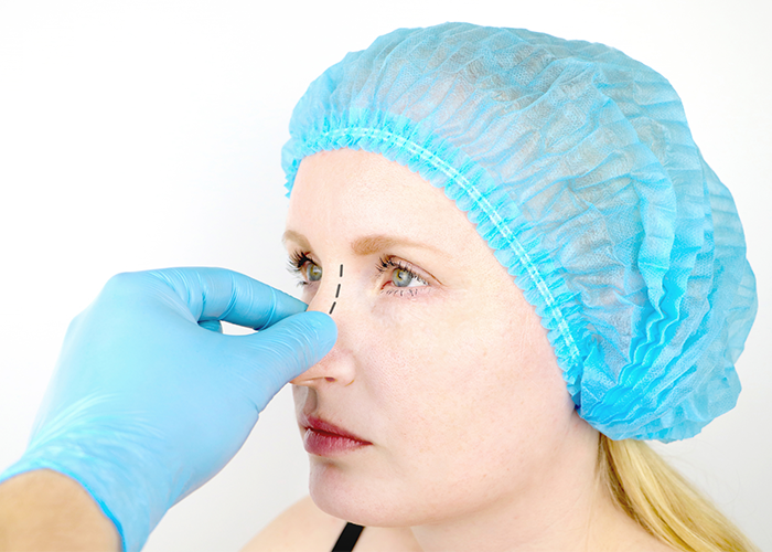 Young woman with blue cap getting prepped for nose surgery to relieve snoring.
