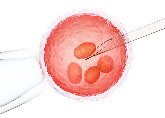Graphic of the harvesting of egg cells from ovary