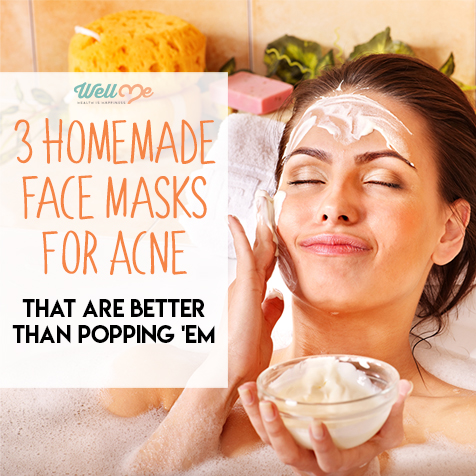 3 Homemade Face Masks For Acne: That Are Better Than Popping 'Em