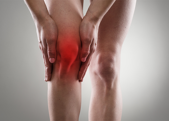 Woman with knee pain