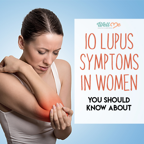 10 Lupus Symptoms in Women You Should Know About
