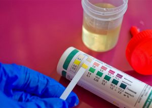 Woman using urine ketosis strips to test her ketone levels