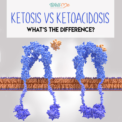 Ketosis vs Ketoacidosis: What's the Difference