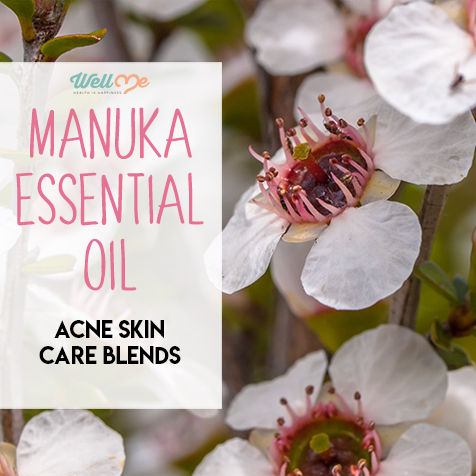 Manuka Essential Oil Acne Skin Care Blends