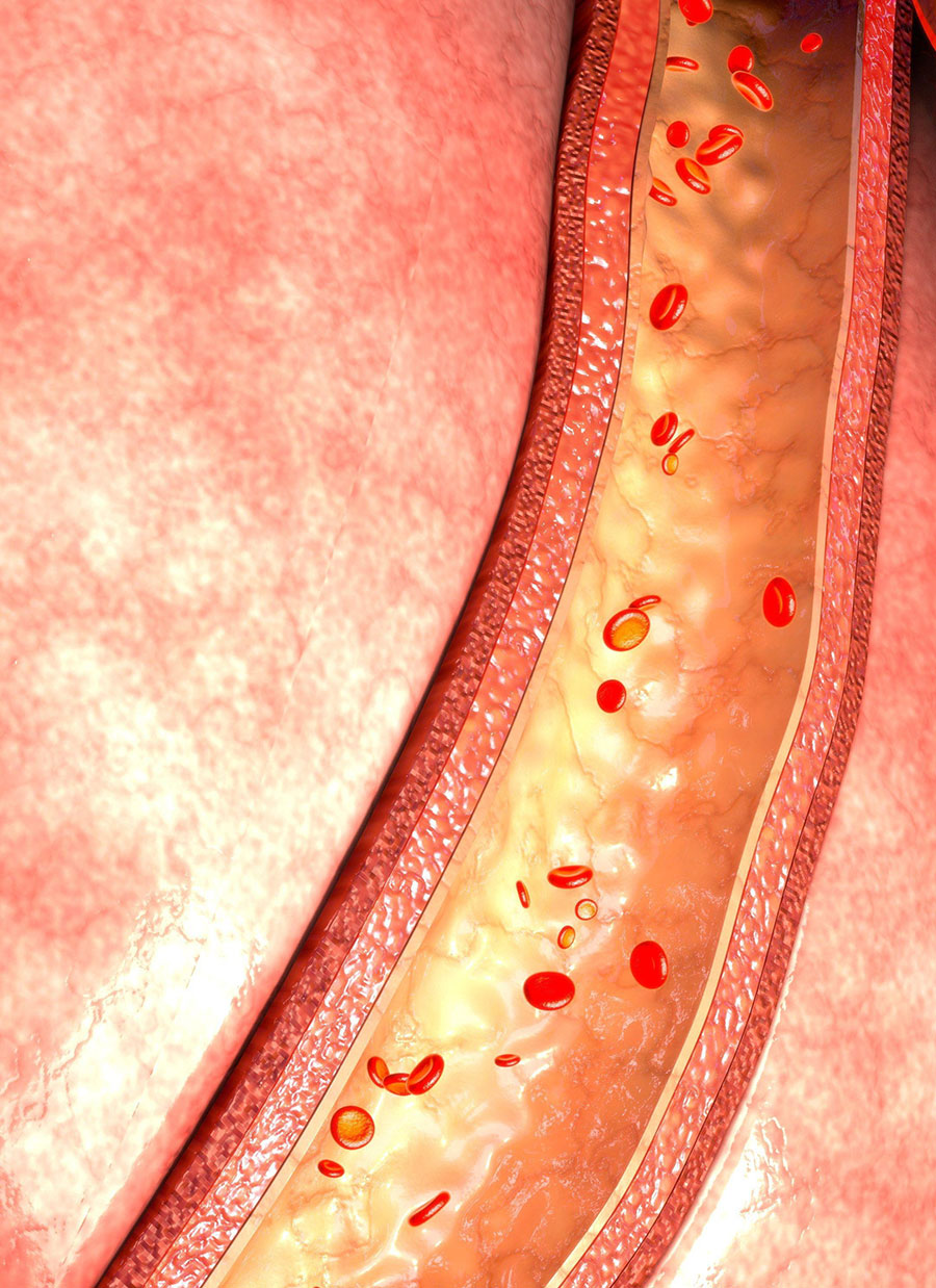 The Connection Between Collagen and Cardiovascular Health WellMe